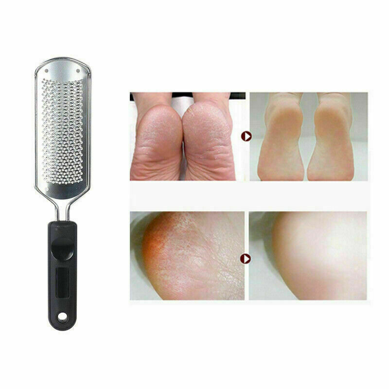 2 in 1 Foot Callus Remover